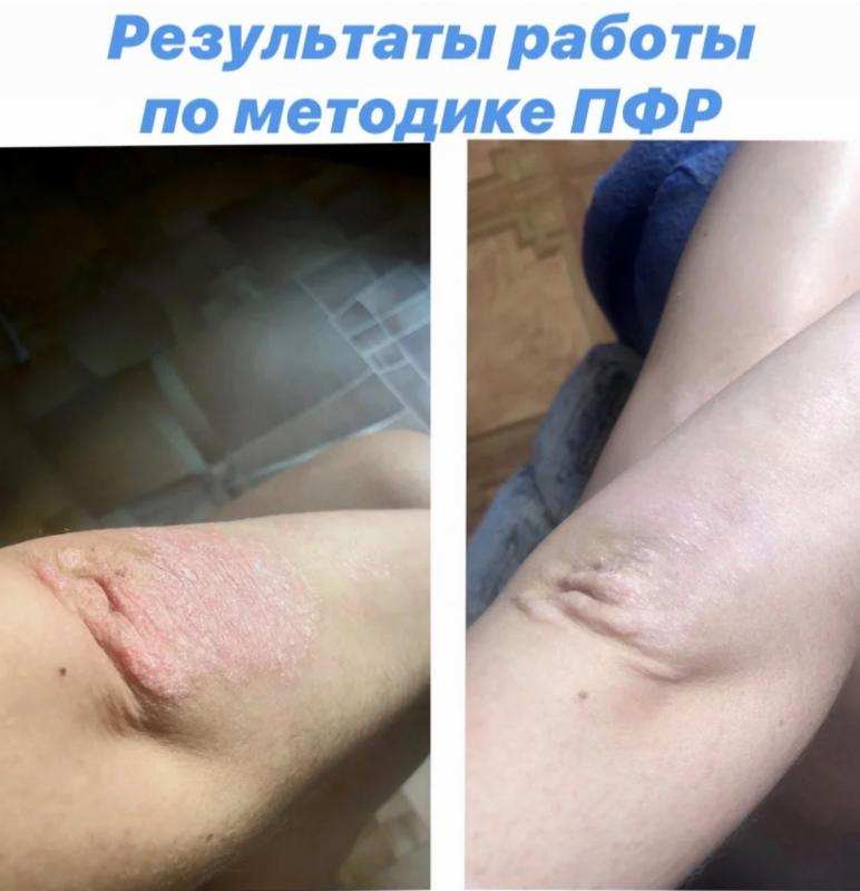 �����-�������������� �������������