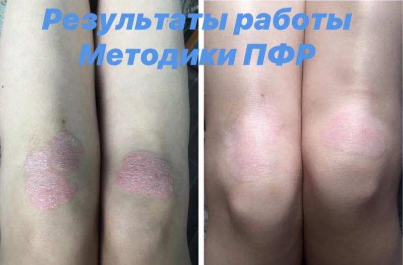 �����-�������������� �������������